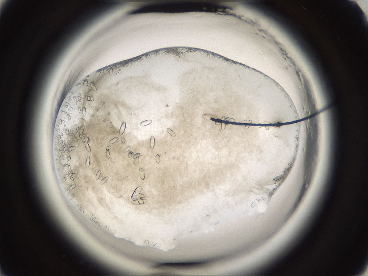folderID661_plateID1661_batchID6964_wellNum57_profileID1_d2_r110553_ef.jpg