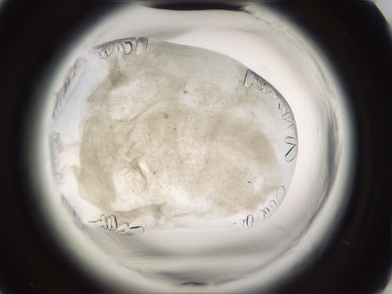 folderID661_plateID1661_batchID6964_wellNum63_profileID1_d2_r110562_ef.jpg