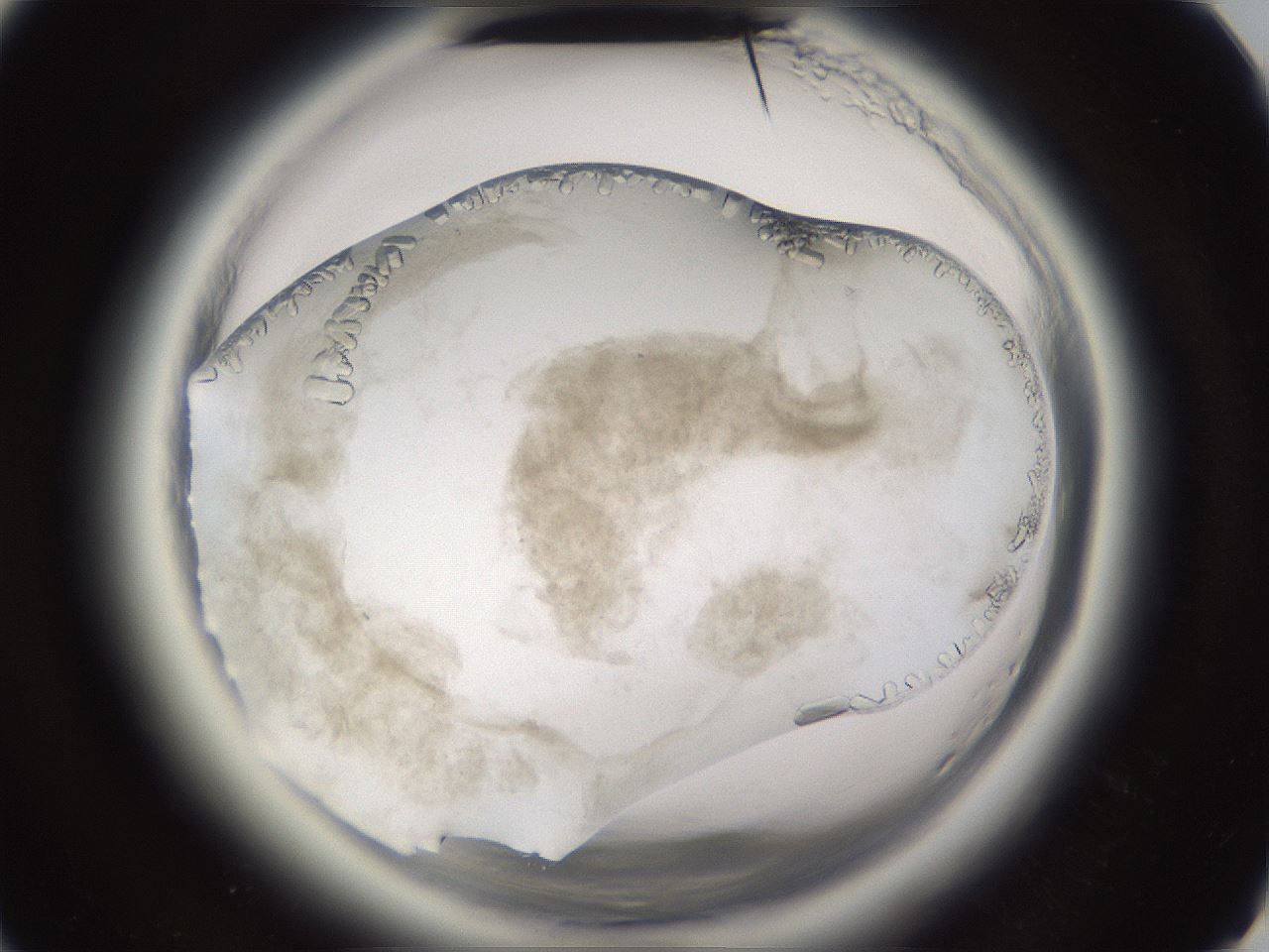 folderID661_plateID1661_batchID6964_wellNum64_profileID1_d3_r110566_ef.jpg