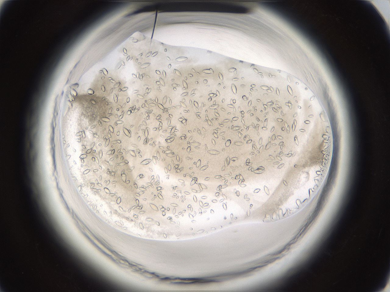 folderID661_plateID1661_batchID6964_wellNum74_profileID1_d1_r110585_ef.jpg