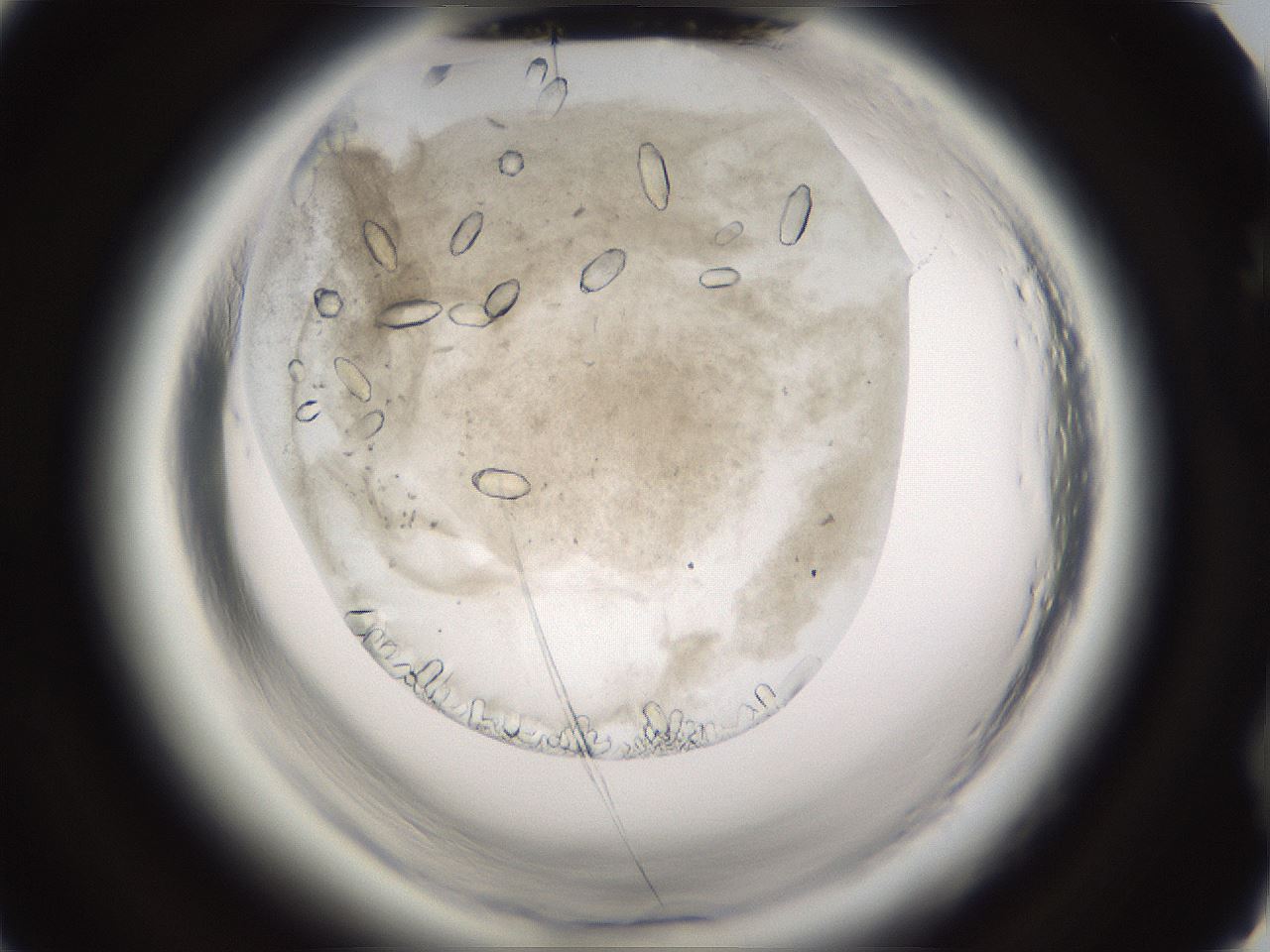 folderID661_plateID1661_batchID6964_wellNum76_profileID1_d2_r110592_ef.jpg