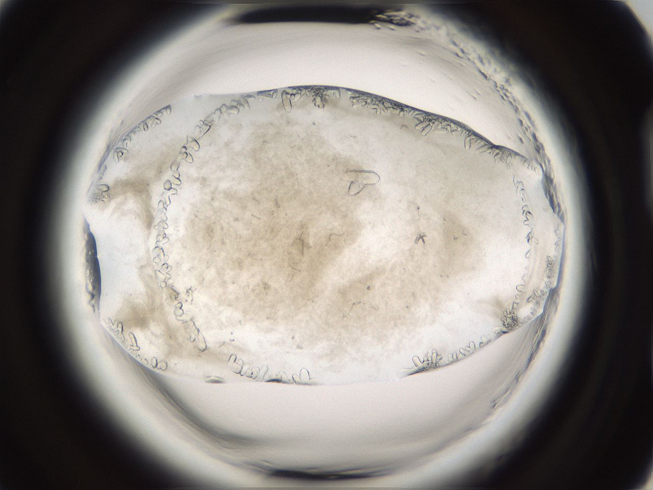 folderID661_plateID1661_batchID6964_wellNum93_profileID1_d2_r110634_ef.jpg