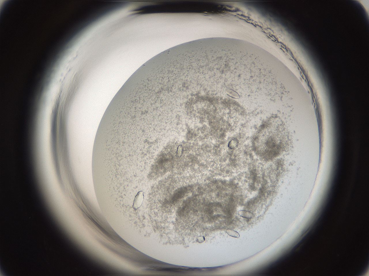 folderID665_plateID1665_batchID6989_wellNum9_profileID1_d3_r110741_ef.jpg