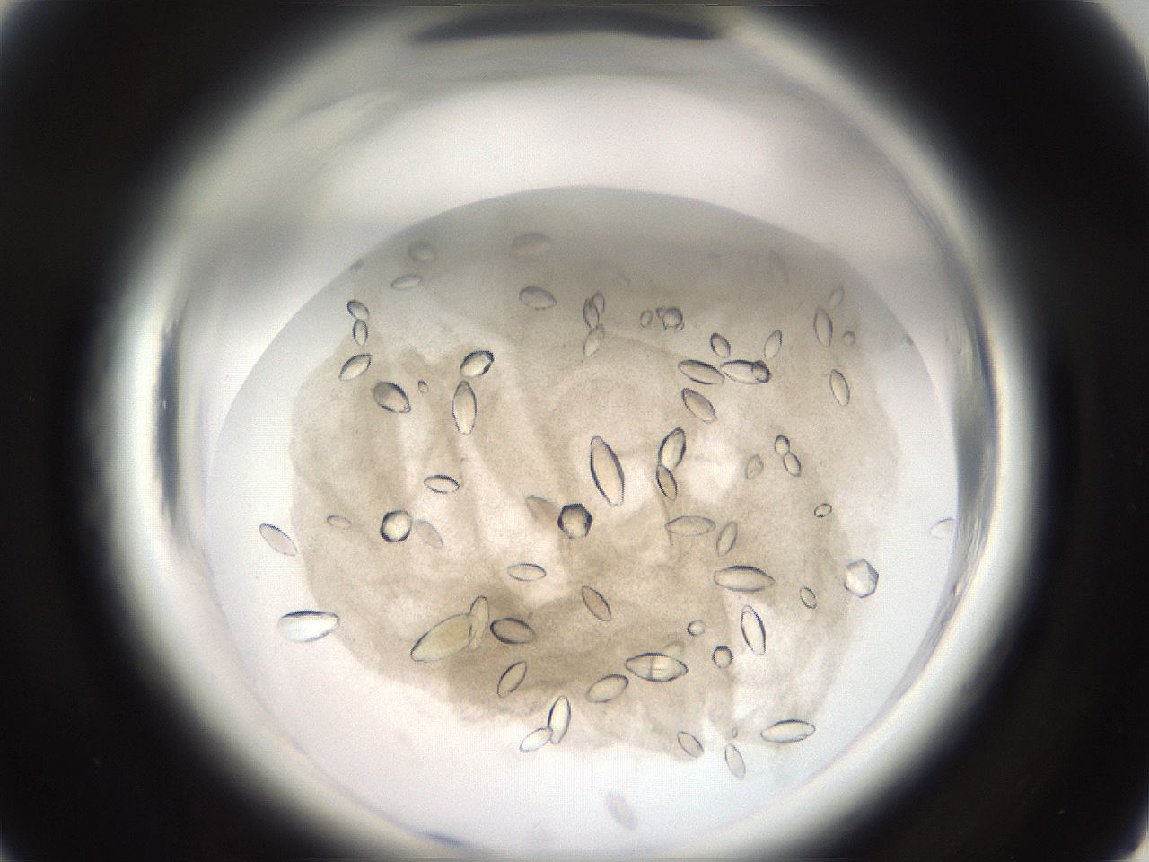 folderID696_plateID1696_batchID7042_wellNum18_profileID1_d1_r112593_ef.jpg