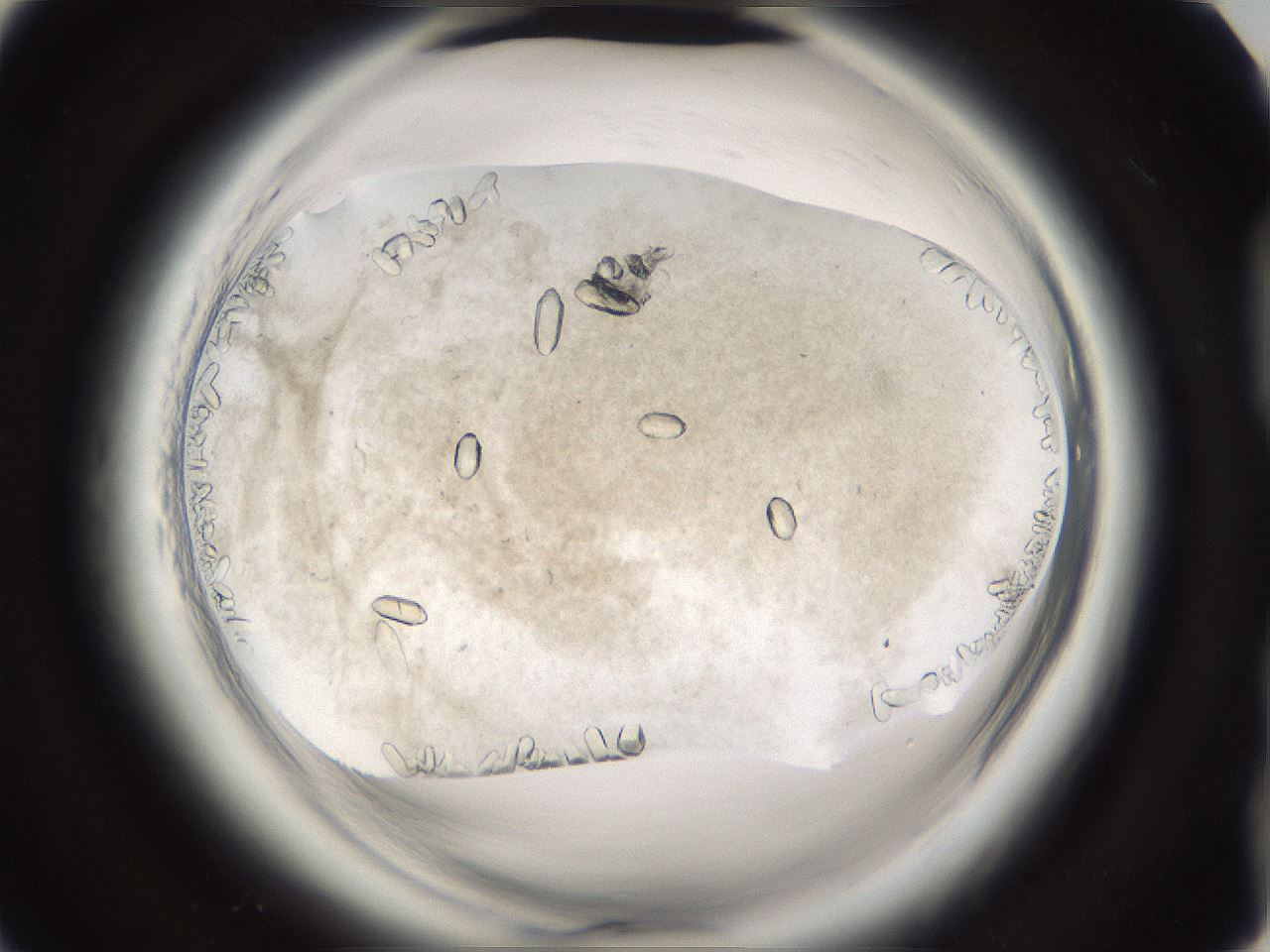 folderID661_plateID1661_batchID6964_wellNum92_profileID1_d2_r110631_ef.jpg