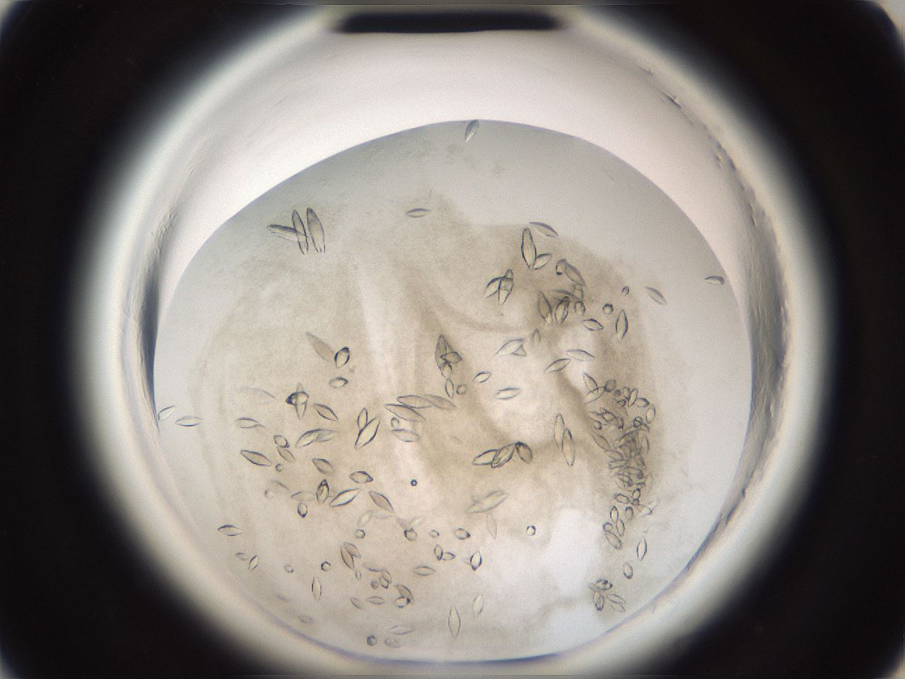 folderID696_plateID1696_batchID7042_wellNum11_profileID1_d2_r112580_ef.jpg