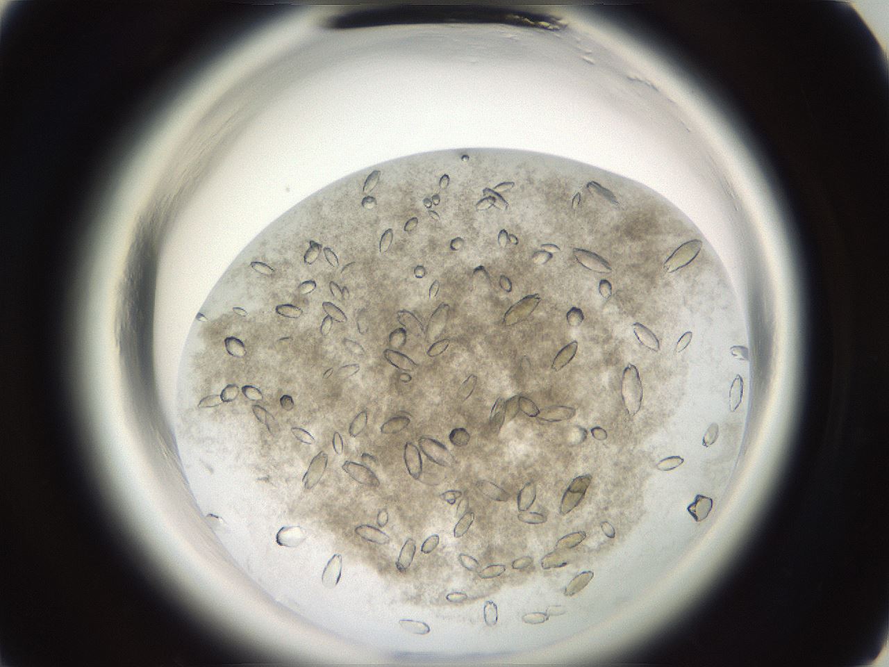folderID696_plateID1696_batchID7042_wellNum5_profileID1_d1_r112567_ef.jpg