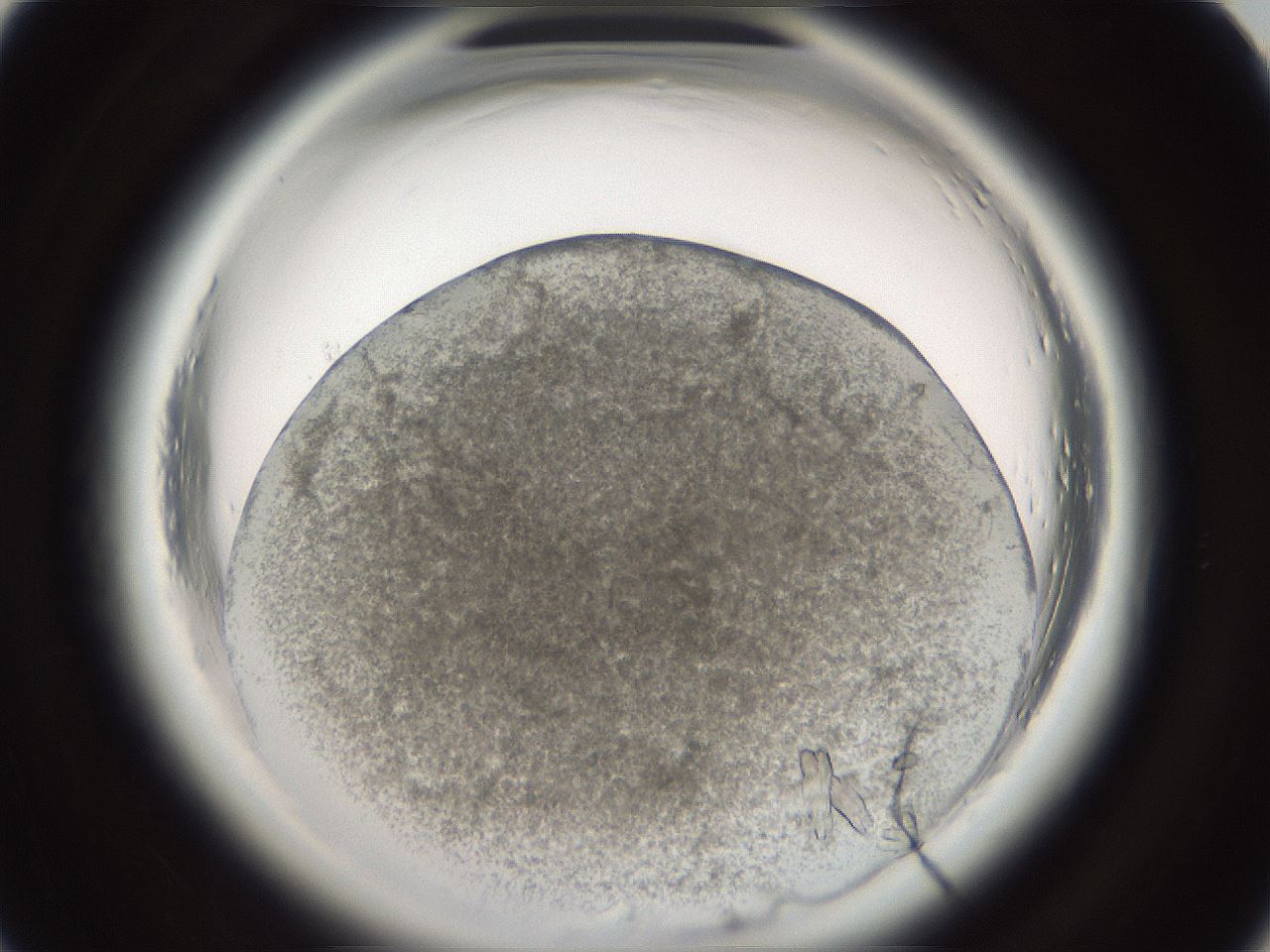 folderID696_plateID1696_batchID7042_wellNum60_profileID1_d1_r112677_ef.jpg