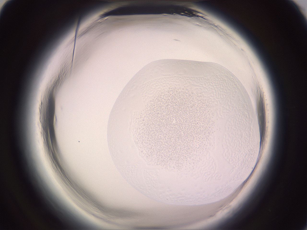 folderID646_plateID2646_batchID13385_wellNum89_profileID1_d1_r213015_ef.jpg