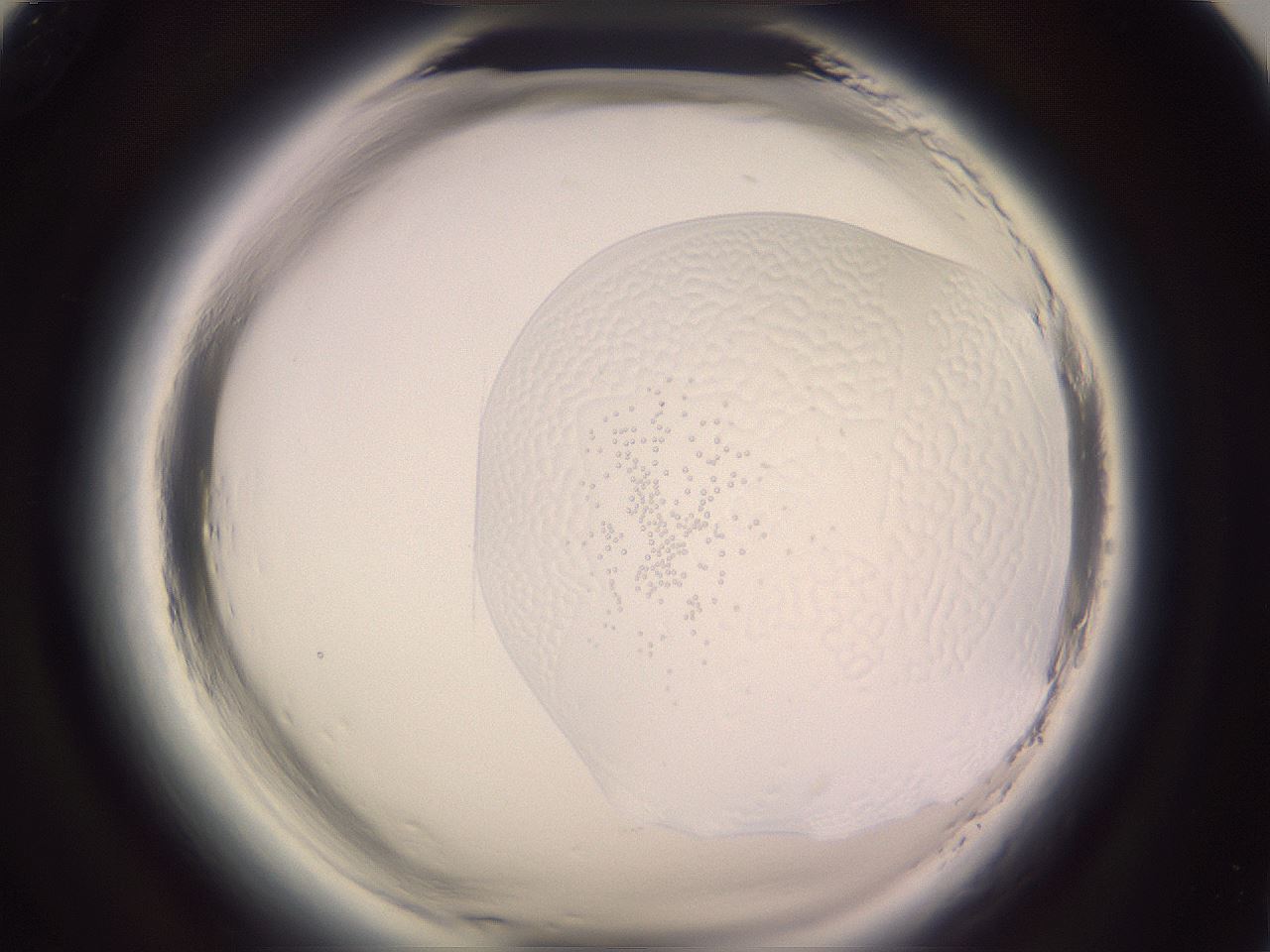 folderID646_plateID2646_batchID13385_wellNum93_profileID1_d1_r213027_ef.jpg