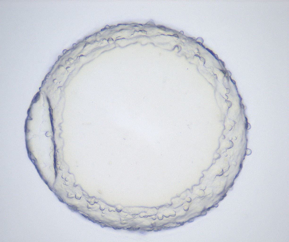 folderID658_plateID2658_batchID13495_wellNum59_profileID1_d1_r212003_ef.jpg
