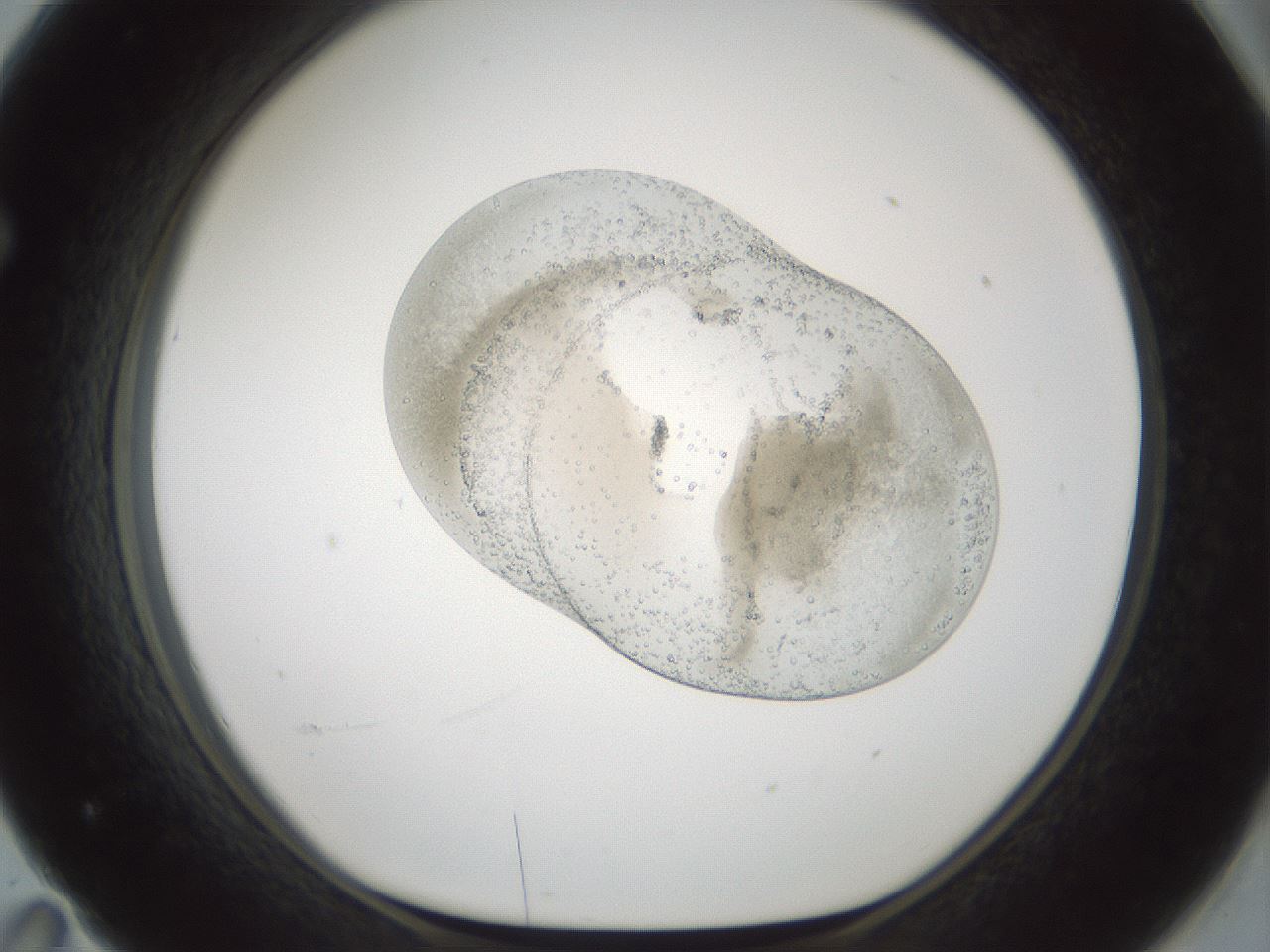 folderID691_plateID2691_batchID13914_wellNum71_profileID1_d1_r219251_ef.jpg