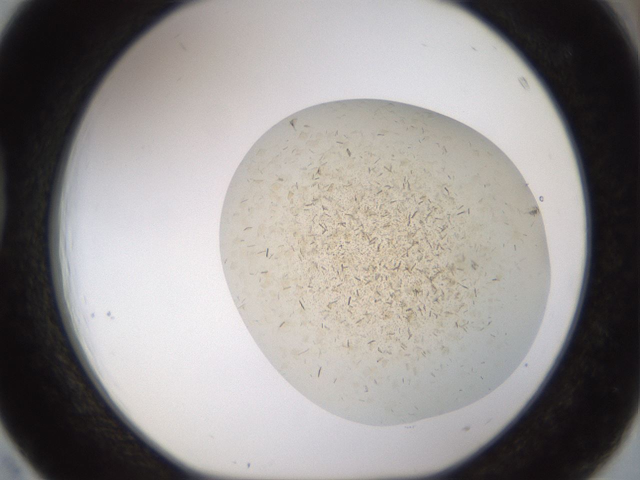 folderID880_plateID1880_batchID8002_wellNum39_profileID1_d1_r126730_ef.jpg