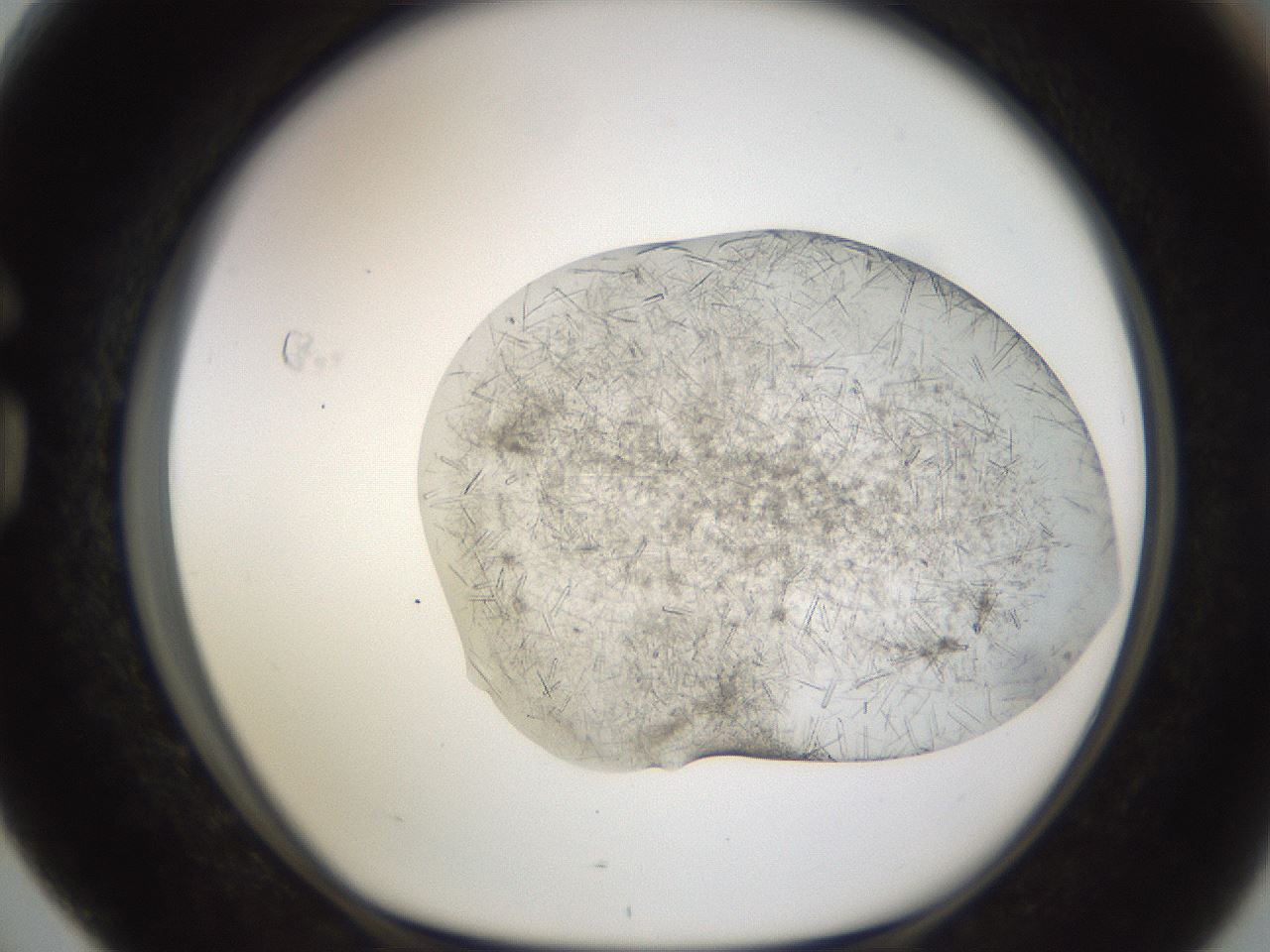 folderID894_plateID2894_batchID15879_wellNum76_profileID1_d1_r242619_ef.jpg