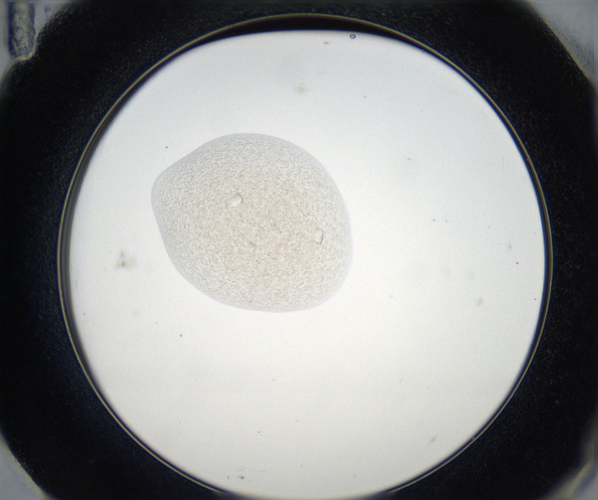 folderID63_plateID2063_batchID9501_wellNum71_profileID1_d2_r142459_ef.jpg