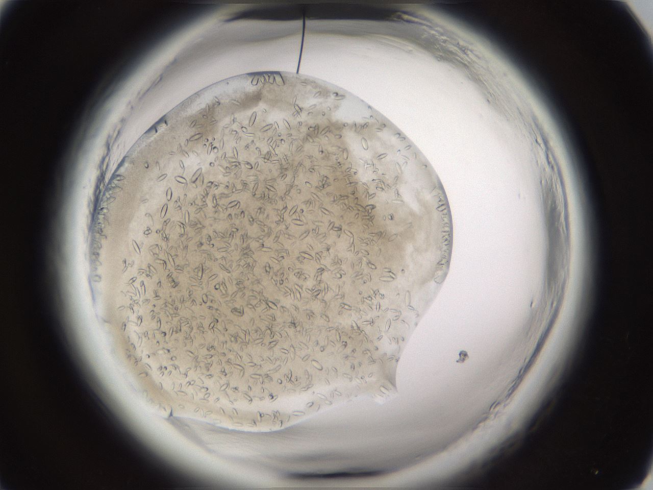 folderID661_plateID1661_batchID6958_wellNum16_profileID1_d1_r110456_ef.jpg