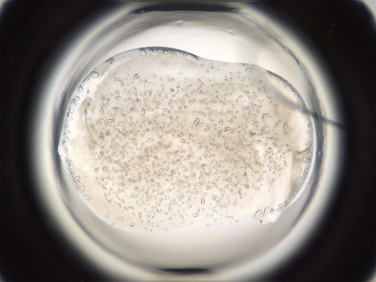 folderID661_plateID1661_batchID6964_wellNum57_profileID1_d1_r110552_ef.jpg