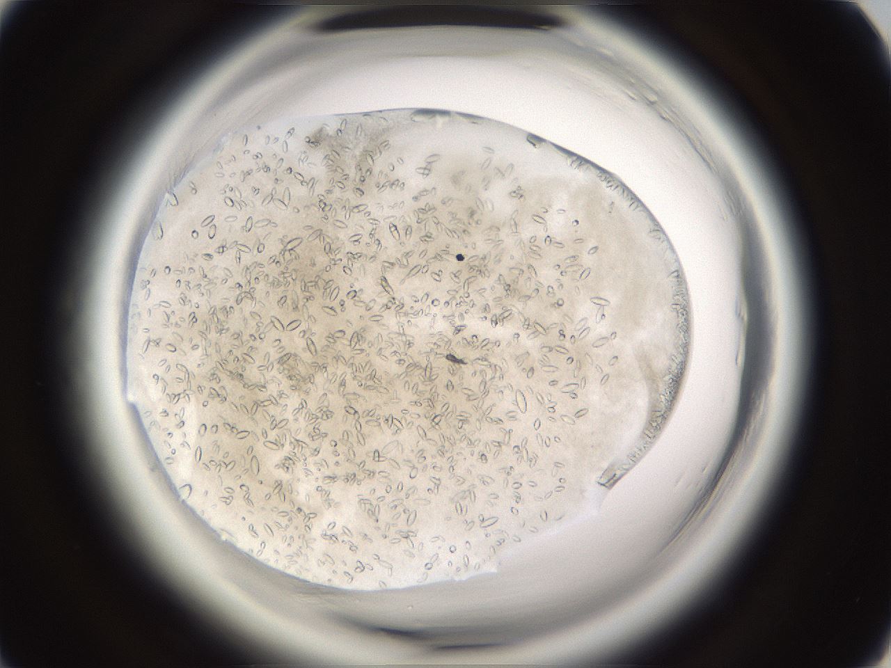 folderID661_plateID1661_batchID6958_wellNum31_profileID1_d1_r110492_ef.jpg