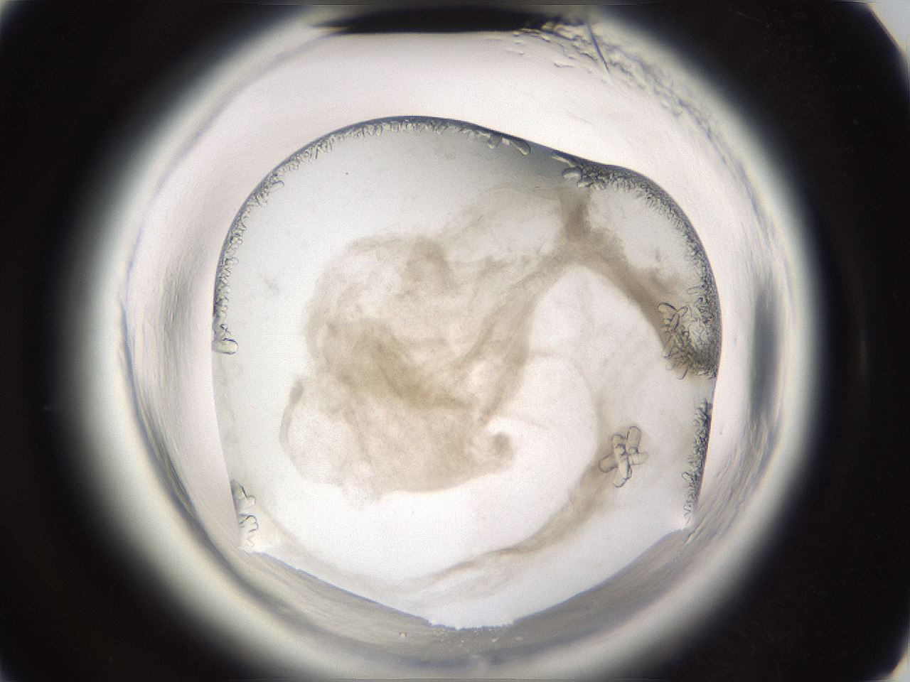 folderID661_plateID1661_batchID6958_wellNum40_profileID1_d3_r110512_ef.jpg