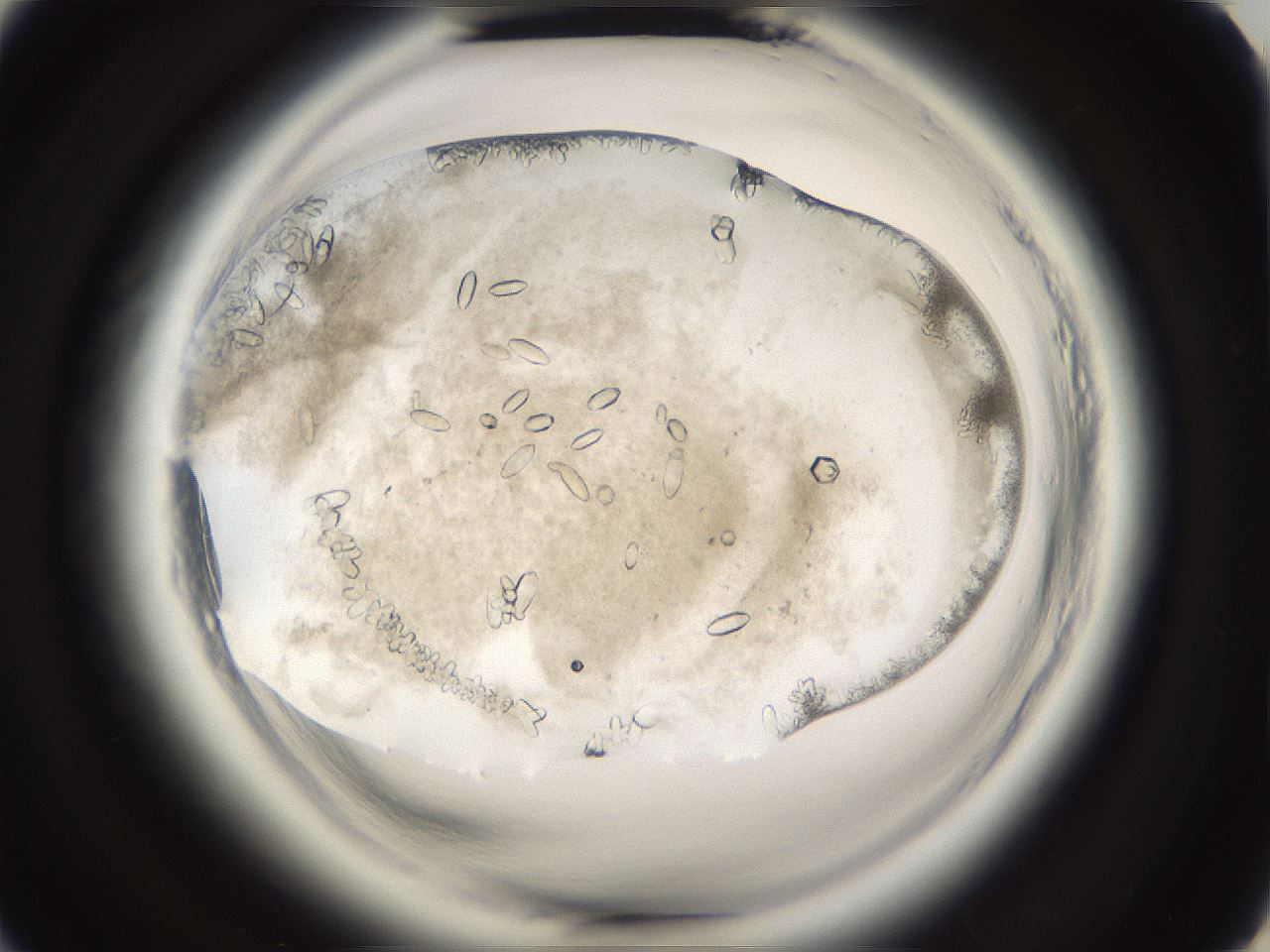 folderID661_plateID1661_batchID6958_wellNum44_profileID1_d2_r110523_ef.jpg