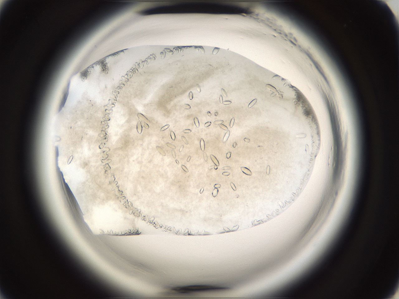 folderID661_plateID1661_batchID6958_wellNum45_profileID1_d2_r110526_ef.jpg
