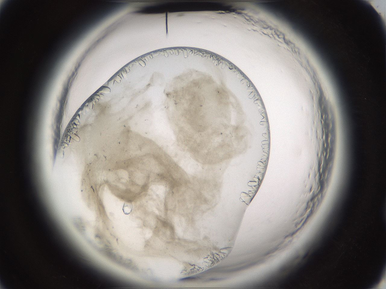 folderID661_plateID1661_batchID6958_wellNum52_profileID1_d2_r110538_ef.jpg