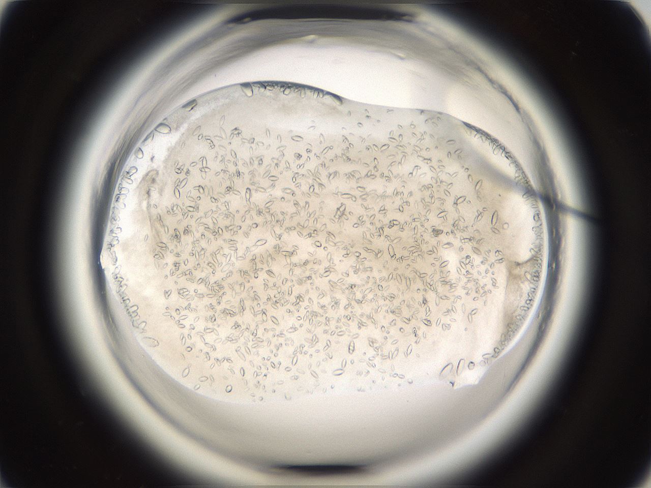 folderID661_plateID1661_batchID6958_wellNum57_profileID1_d1_r110552_ef.jpg