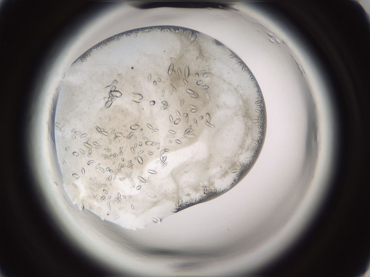 folderID661_plateID1661_batchID6958_wellNum5_profileID1_d2_r110649_ef.jpg