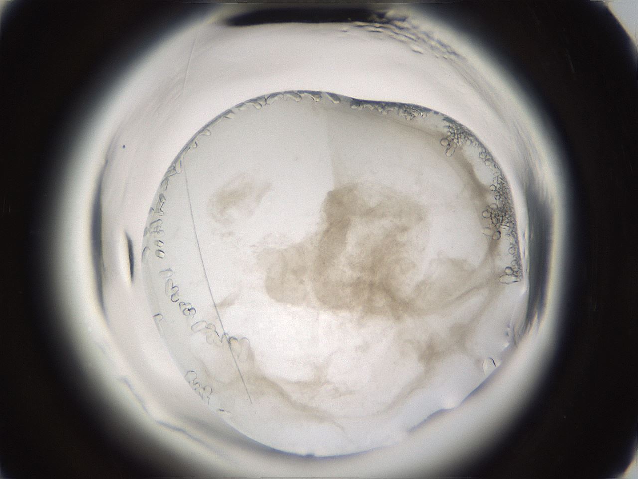 folderID661_plateID1661_batchID6958_wellNum89_profileID1_d3_r110623_ef.jpg