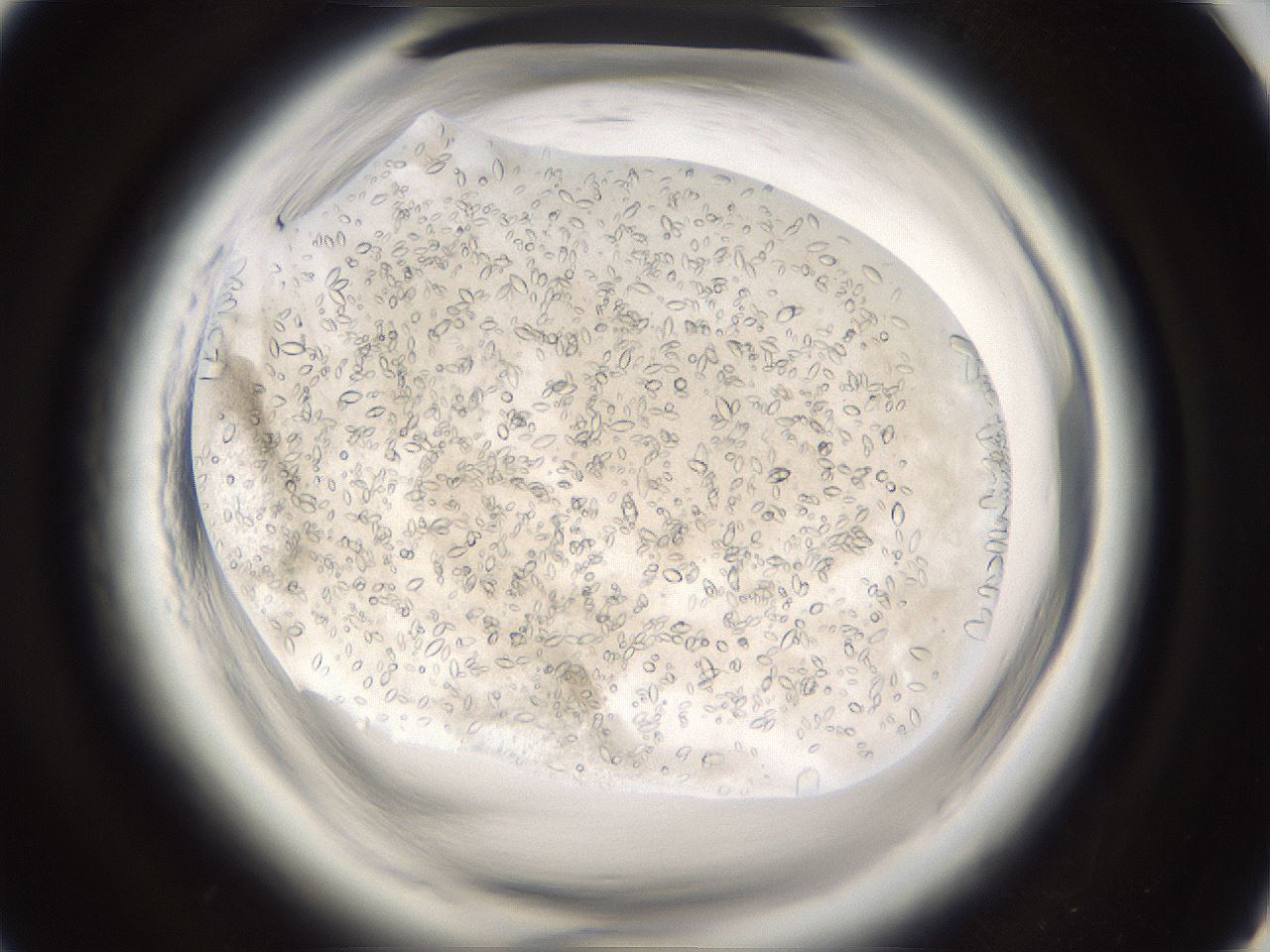 folderID661_plateID1661_batchID6958_wellNum92_profileID1_d1_r110630_ef.jpg