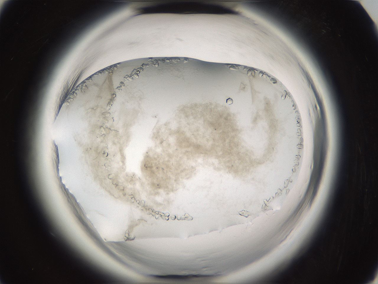 folderID661_plateID1661_batchID6958_wellNum92_profileID1_d3_r110632_ef.jpg