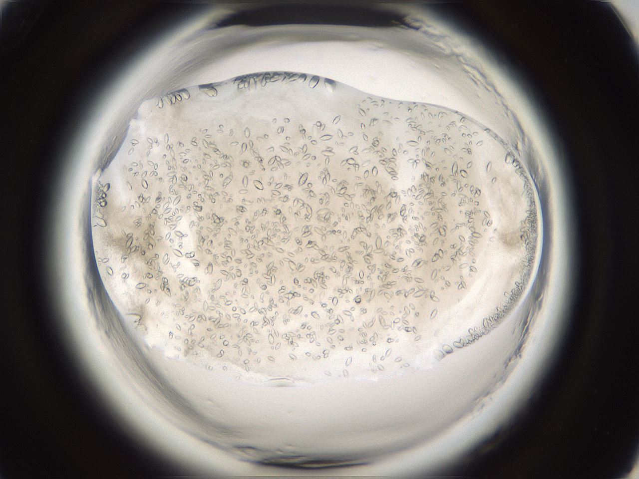 folderID661_plateID1661_batchID6958_wellNum93_profileID1_d1_r110633_ef.jpg