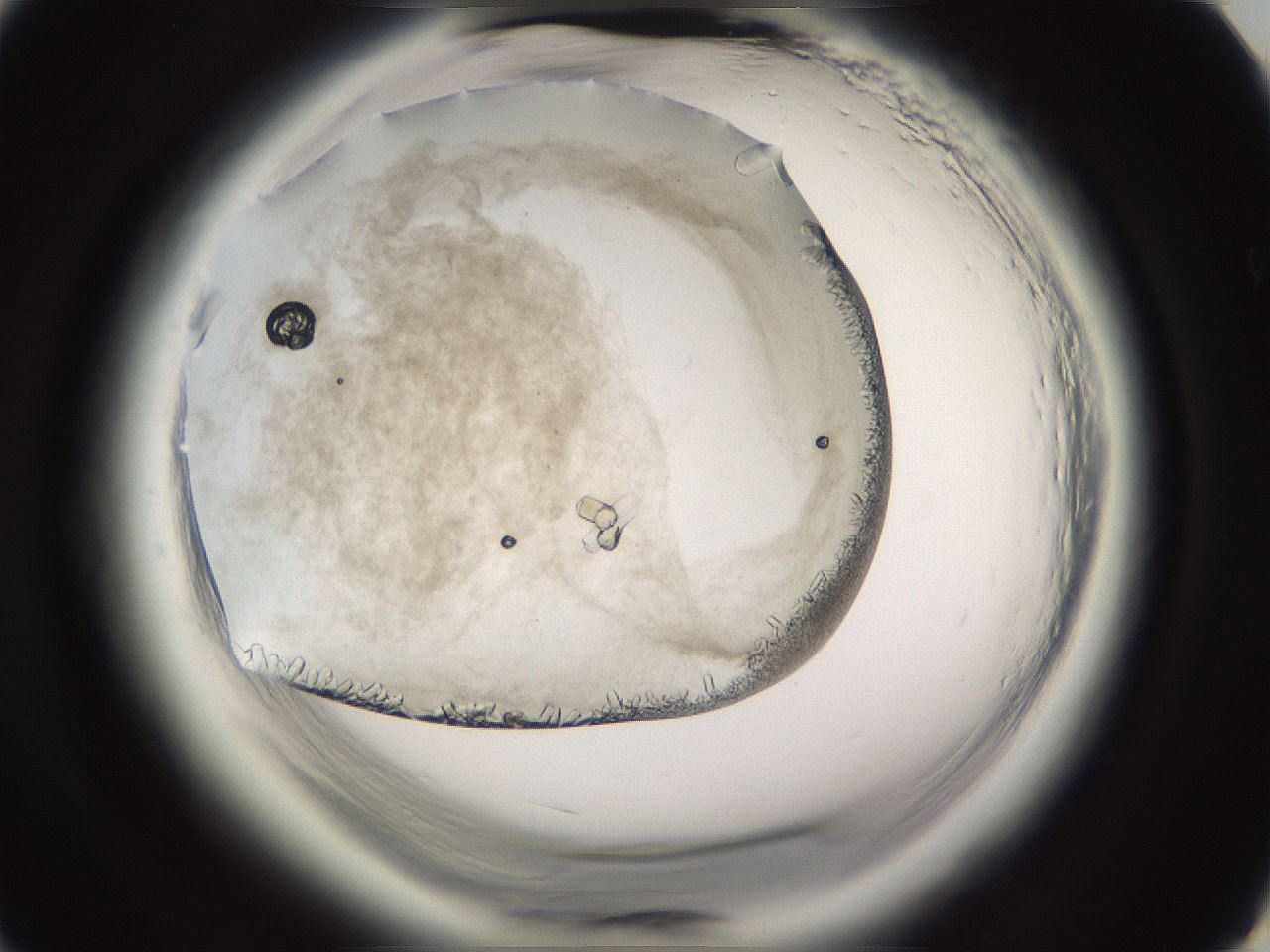 folderID661_plateID1661_batchID6961_wellNum15_profileID1_d3_r110455_ef.jpg