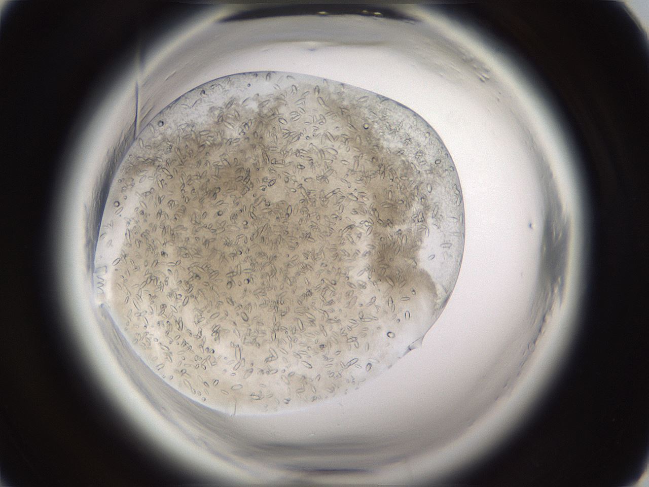 folderID661_plateID1661_batchID6961_wellNum17_profileID1_d1_r110459_ef.jpg