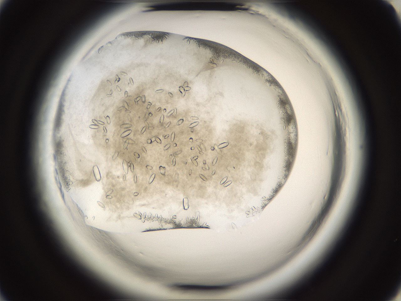 folderID661_plateID1661_batchID6961_wellNum20_profileID1_d2_r110469_ef.jpg