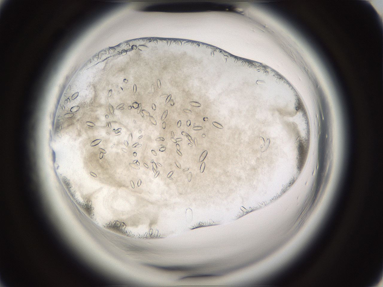 folderID661_plateID1661_batchID6961_wellNum31_profileID1_d2_r110493_ef.jpg