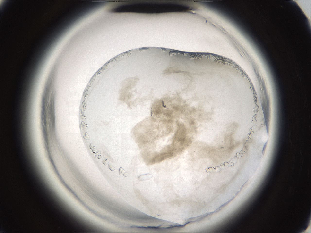 folderID661_plateID1661_batchID6958_wellNum90_profileID1_d3_r110626_ef.jpg