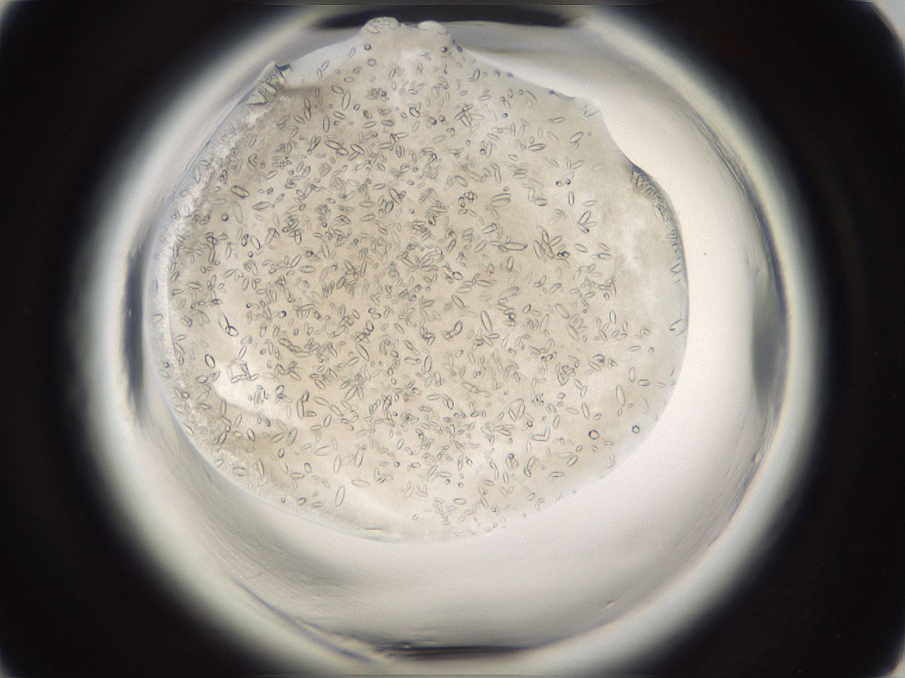 folderID661_plateID1661_batchID6961_wellNum18_profileID1_d1_r110462_ef.jpg