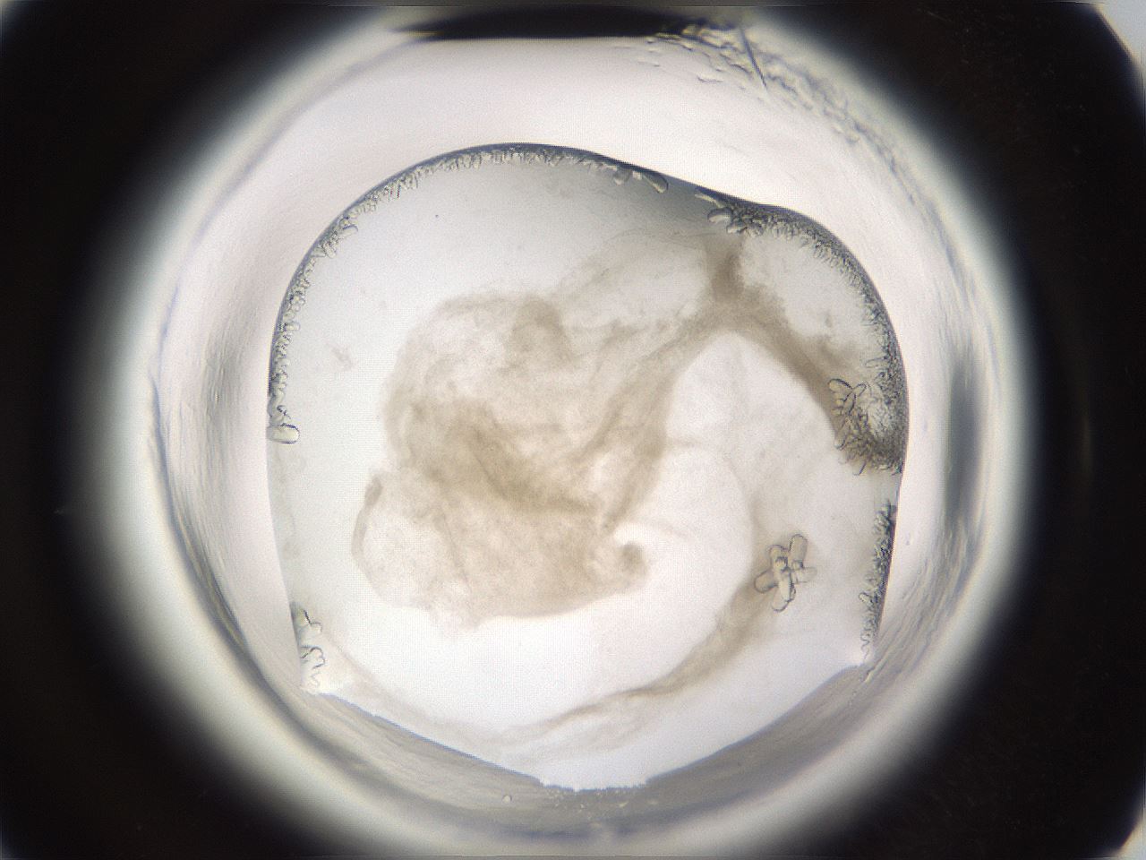 folderID661_plateID1661_batchID6961_wellNum40_profileID1_d3_r110512_ef.jpg
