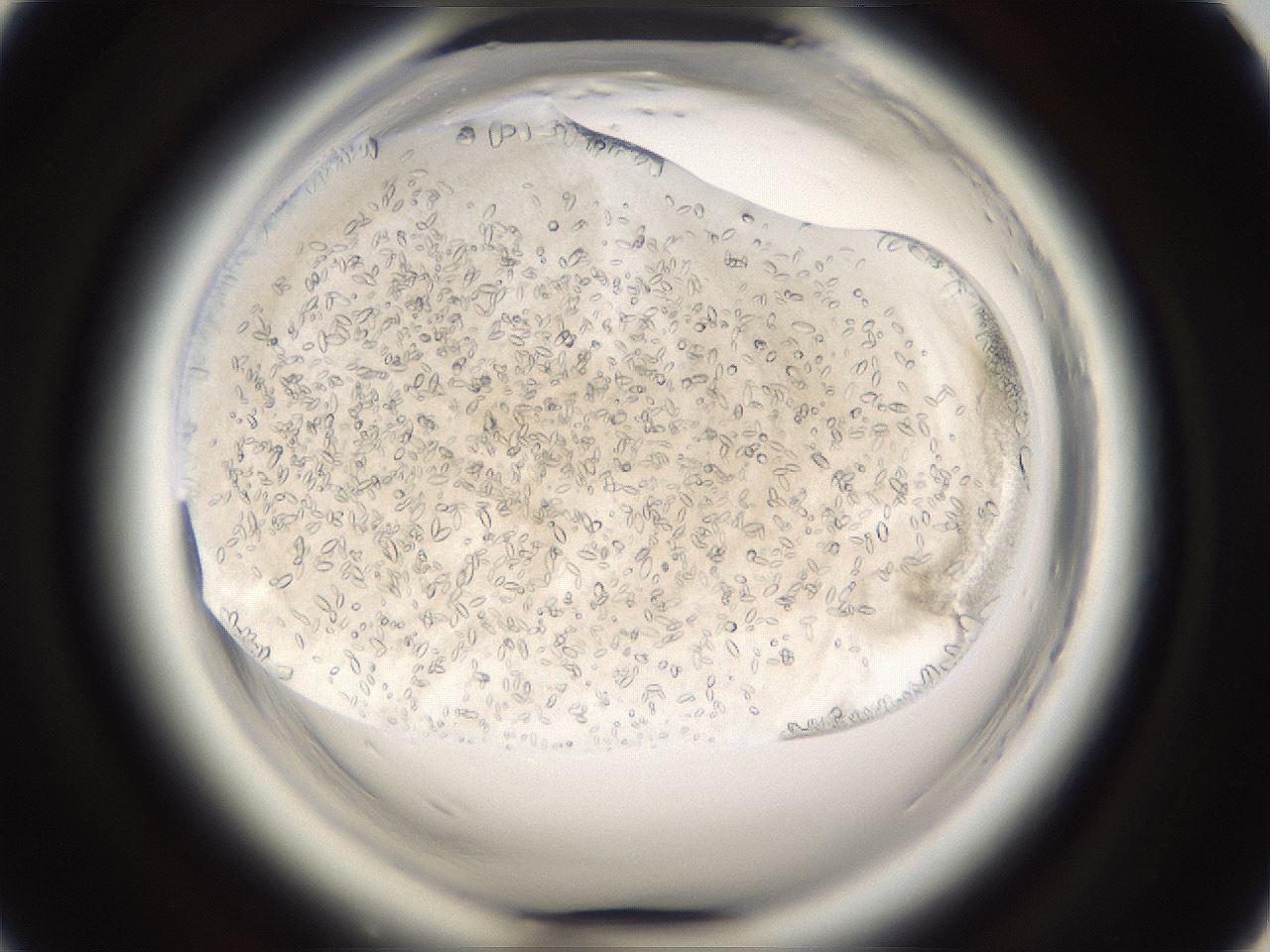 folderID661_plateID1661_batchID6961_wellNum45_profileID1_d1_r110525_ef.jpg
