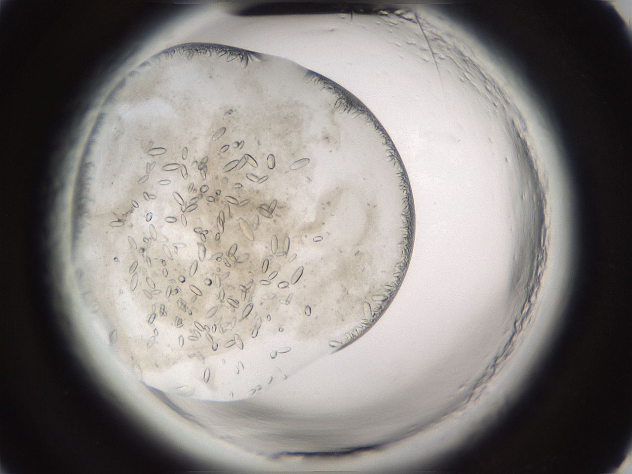 folderID661_plateID1661_batchID6961_wellNum4_profileID1_d2_r110646_ef.jpg