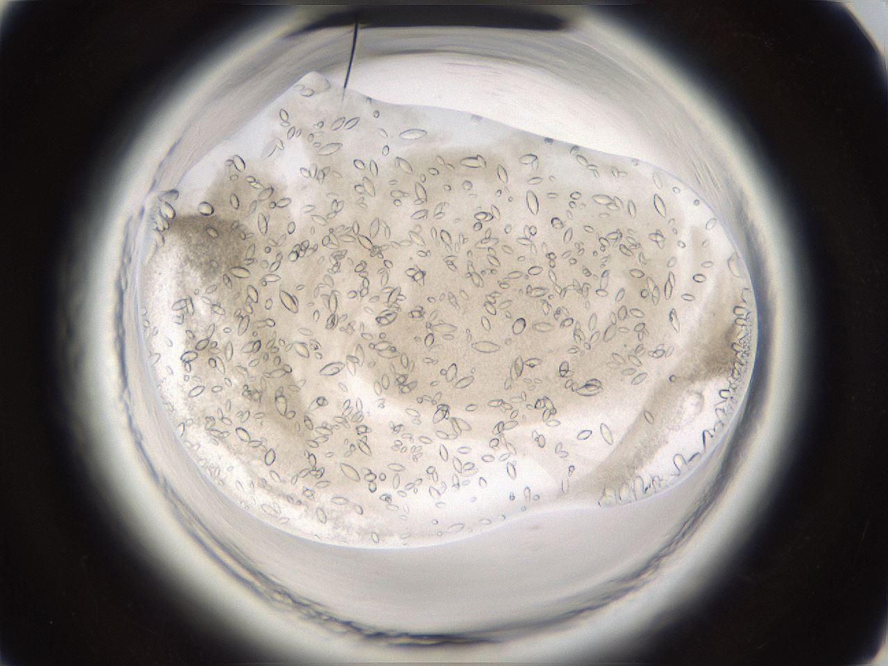 folderID661_plateID1661_batchID6961_wellNum74_profileID1_d1_r110585_ef.jpg