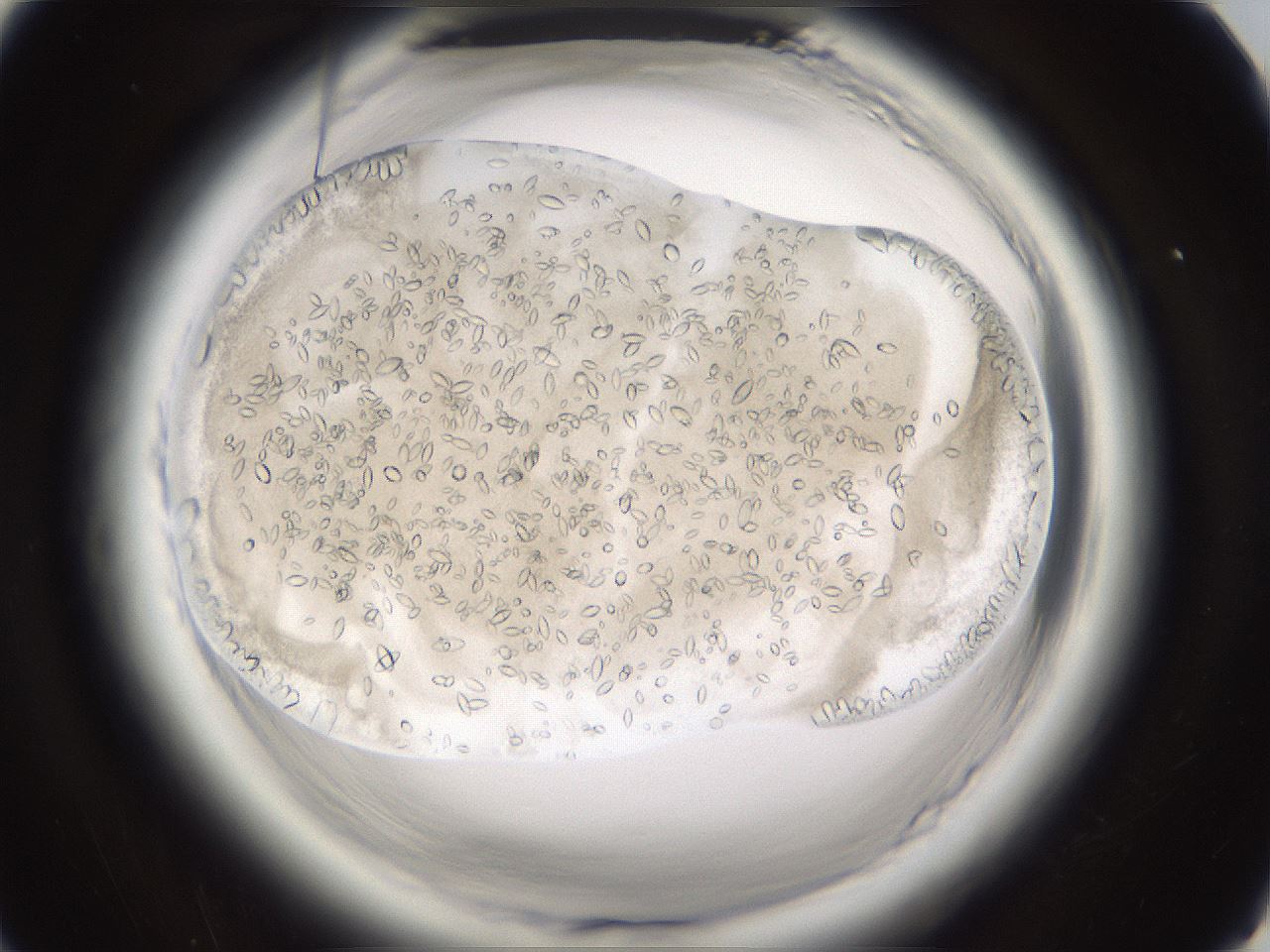 folderID661_plateID1661_batchID6961_wellNum77_profileID1_d1_r110594_ef.jpg