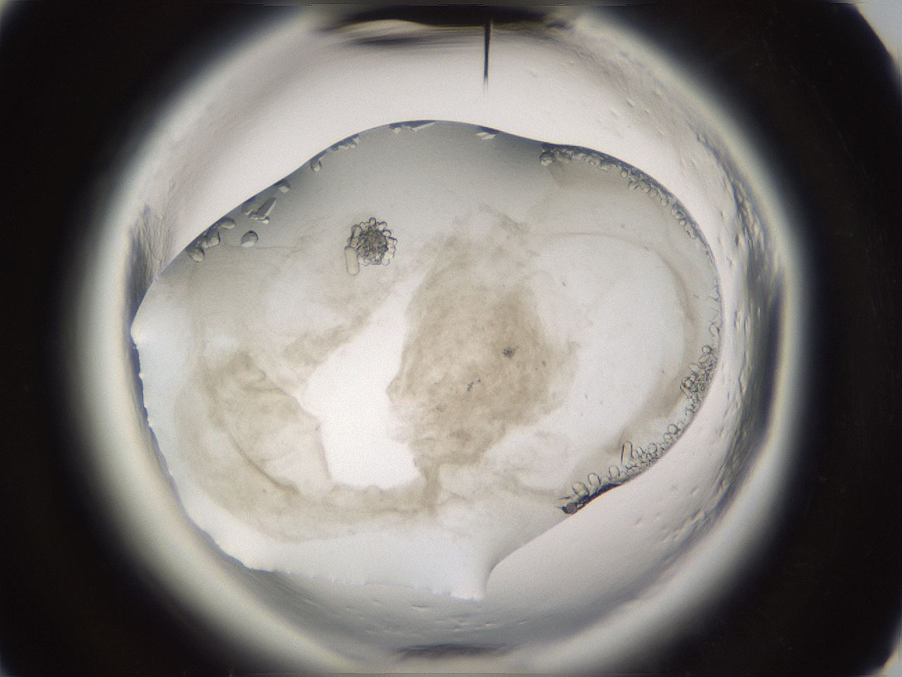 folderID661_plateID1661_batchID6961_wellNum88_profileID1_d3_r110620_ef.jpg