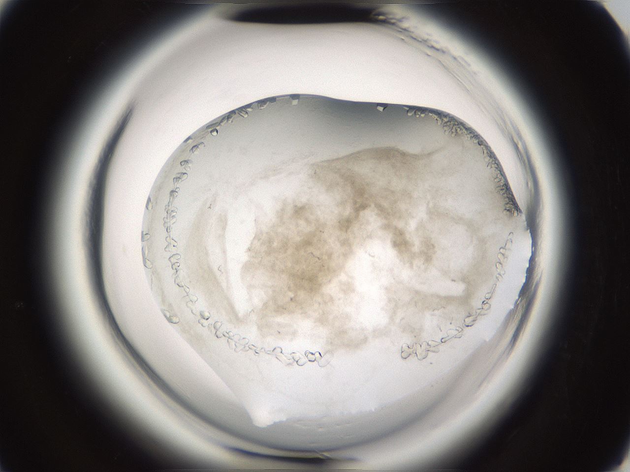 folderID661_plateID1661_batchID6961_wellNum91_profileID1_d3_r110629_ef.jpg