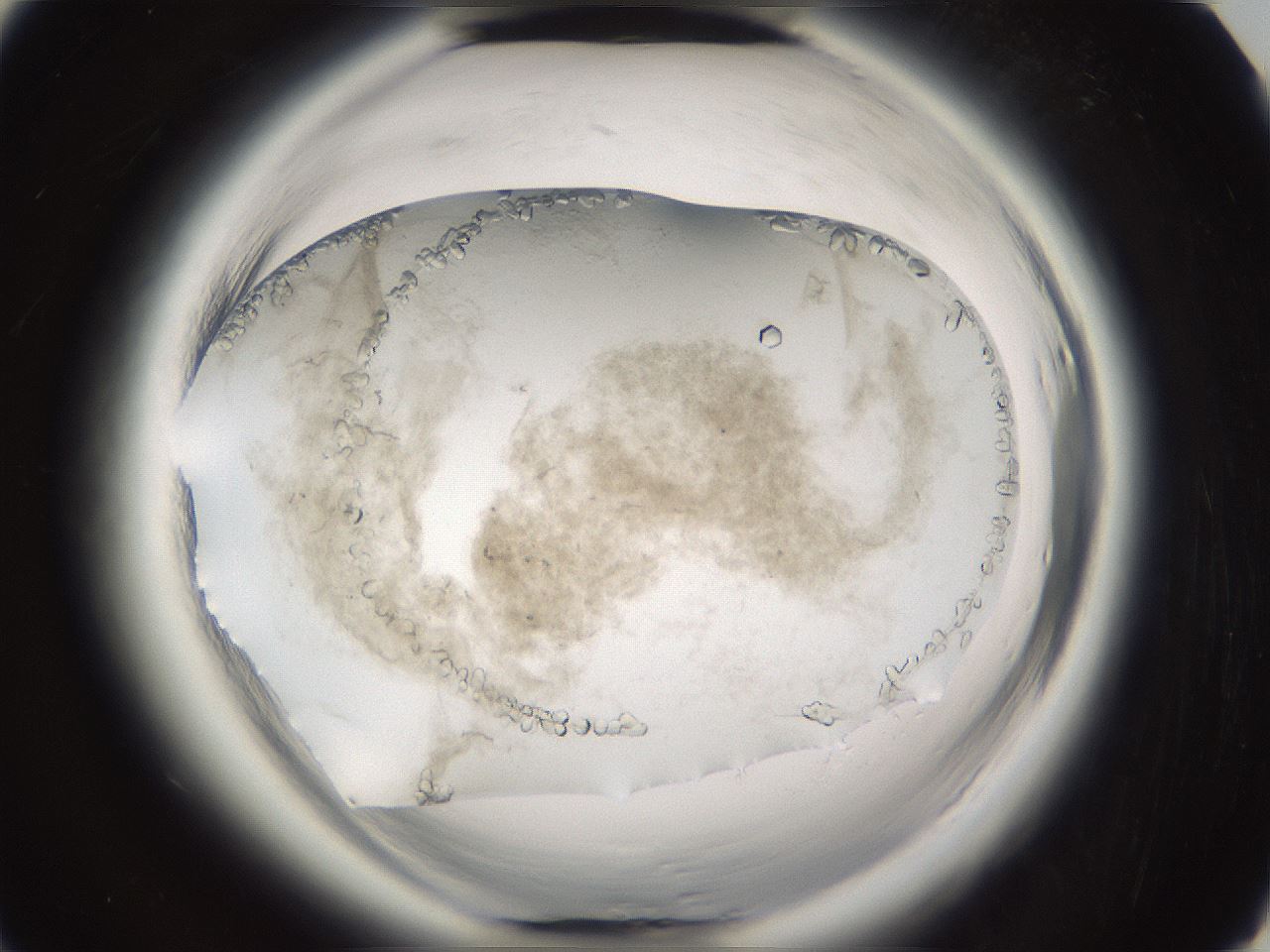 folderID661_plateID1661_batchID6961_wellNum92_profileID1_d3_r110632_ef.jpg