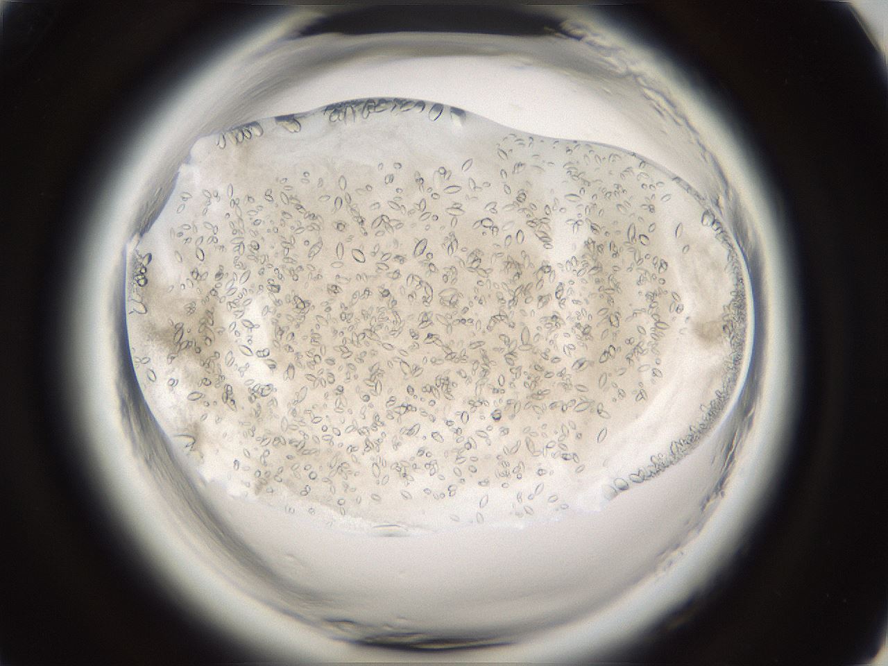 folderID661_plateID1661_batchID6961_wellNum93_profileID1_d1_r110633_ef.jpg