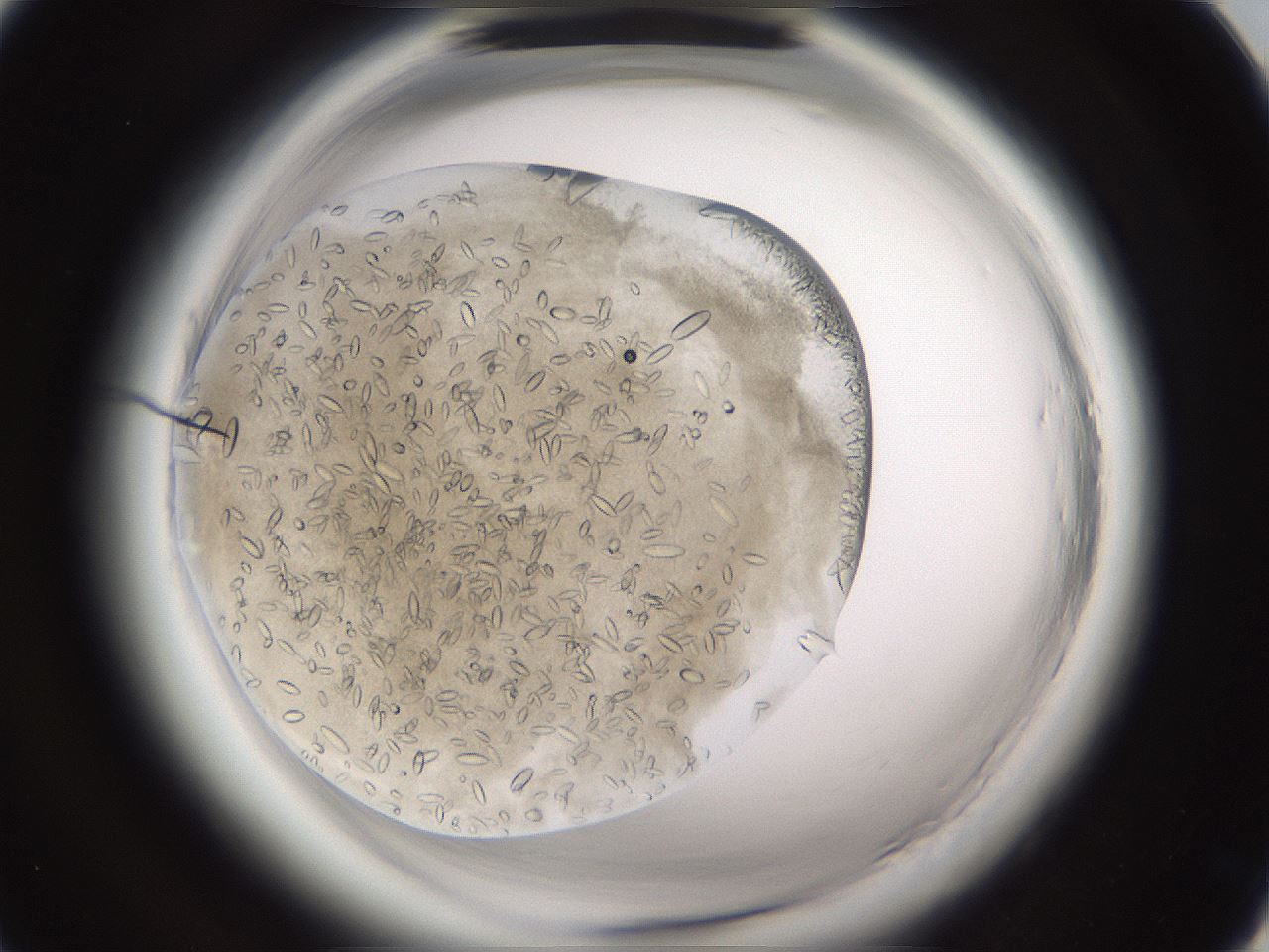 folderID661_plateID1661_batchID6964_wellNum13_profileID1_d1_r110447_ef.jpg