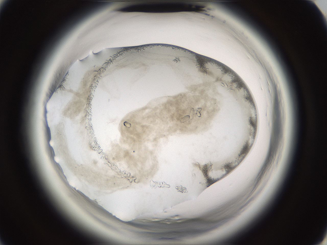 folderID661_plateID1661_batchID6964_wellNum31_profileID1_d3_r110494_ef.jpg