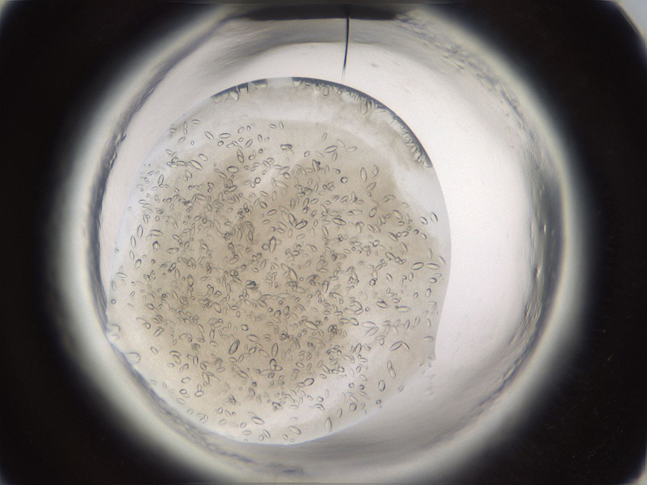folderID661_plateID1661_batchID6964_wellNum52_profileID1_d1_r110537_ef.jpg